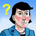 O que é a acne e porque temos cravos e espinhas?