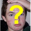 Causas da acne e a importância de saber como lidar com o problema.